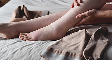 Lipödemli Bireylerde Anti-inflamatuar Diyet Yaşam Kalitesini Artırıyor